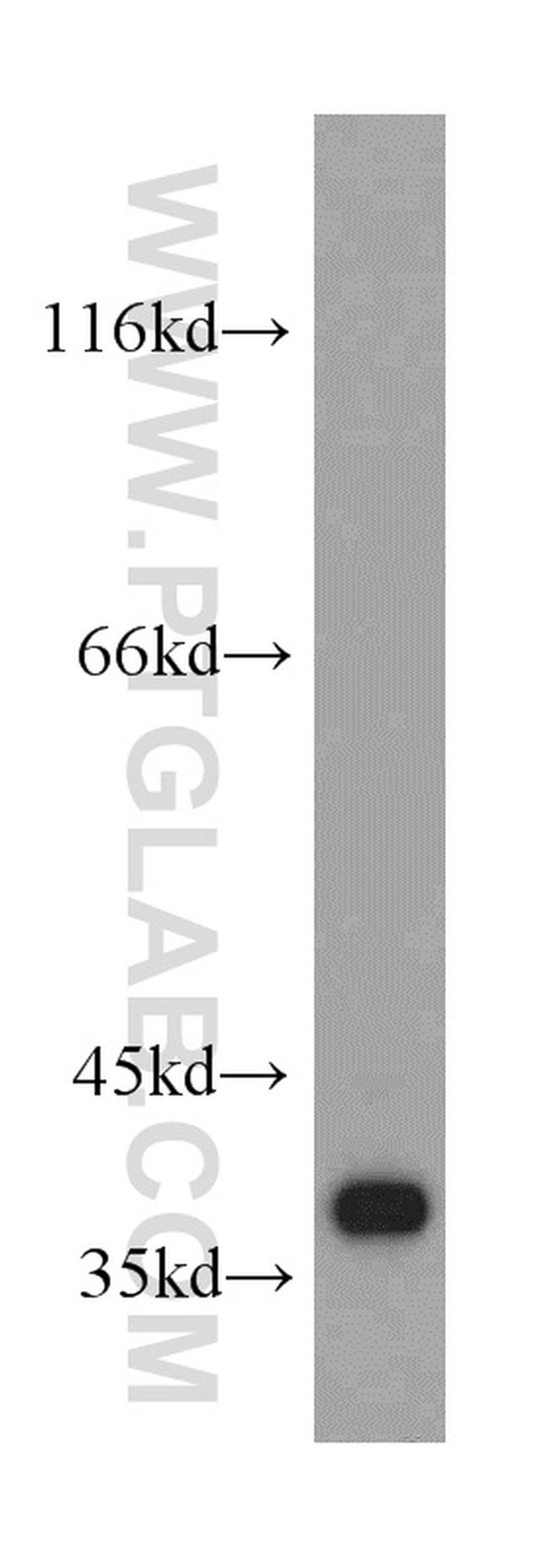 CCDC50 Antibody in Western Blot (WB)