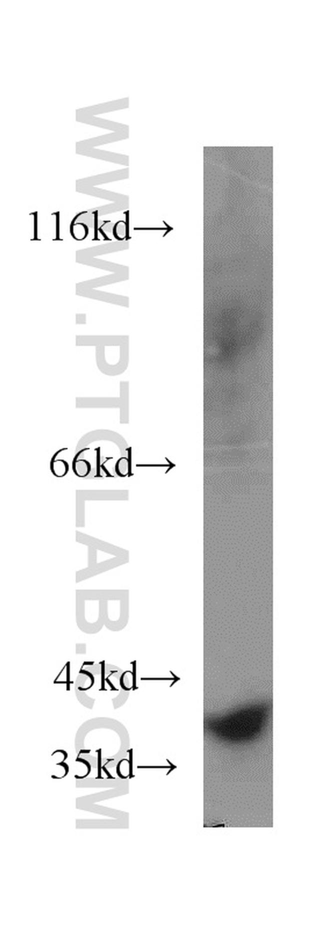 CCDC50 Antibody in Western Blot (WB)