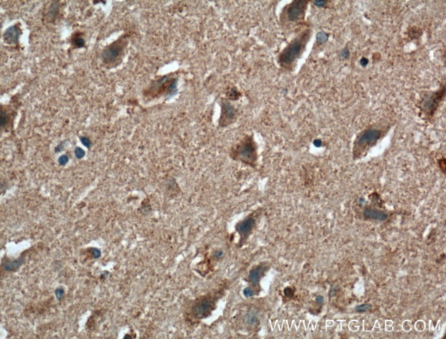 AFAP1 Antibody in Immunohistochemistry (Paraffin) (IHC (P))