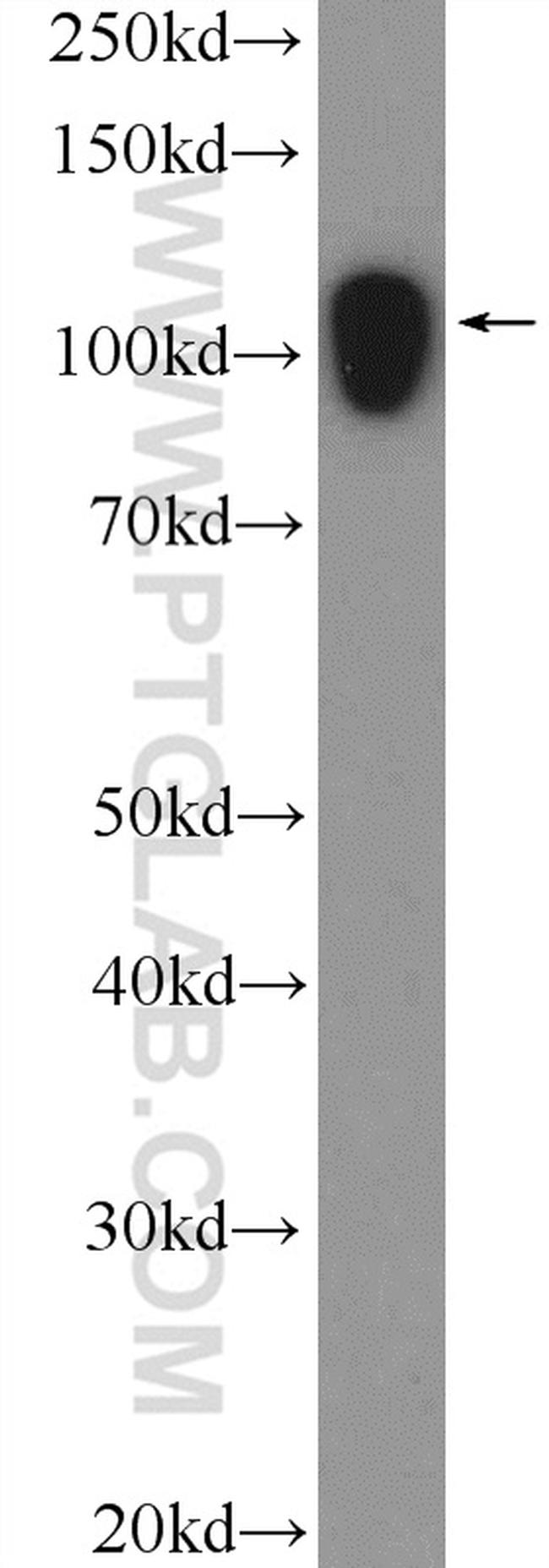 AFAP1 Antibody in Western Blot (WB)