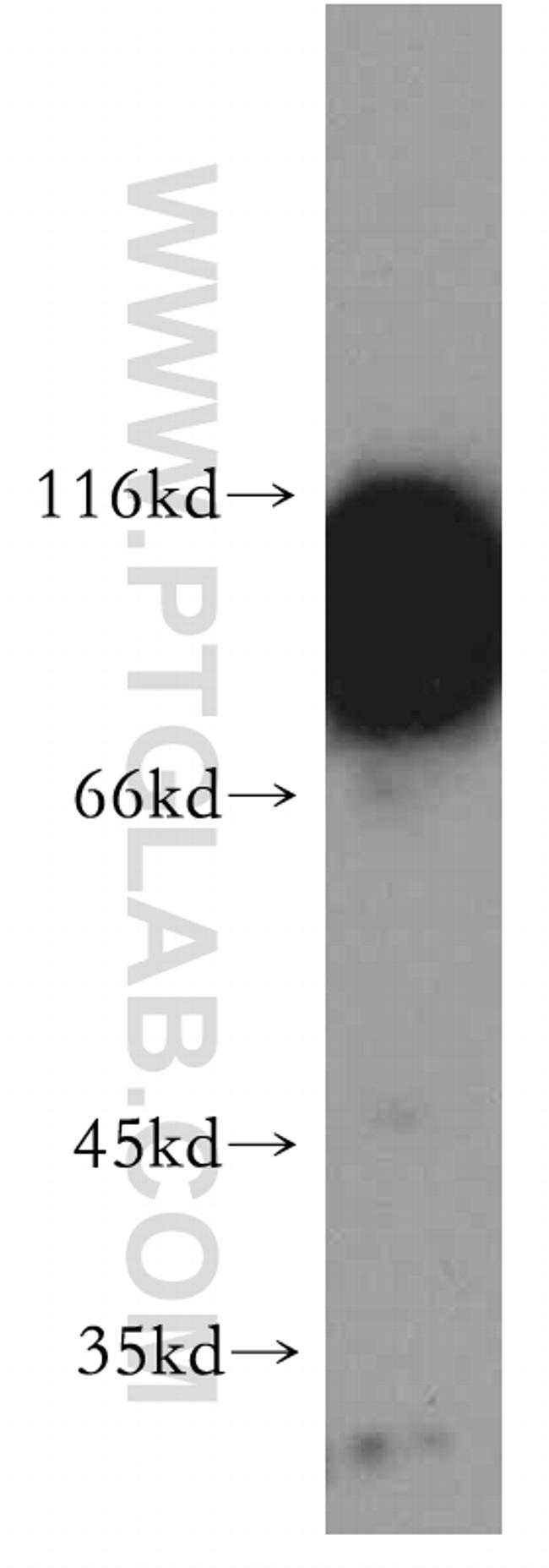 AFAP1 Antibody in Western Blot (WB)