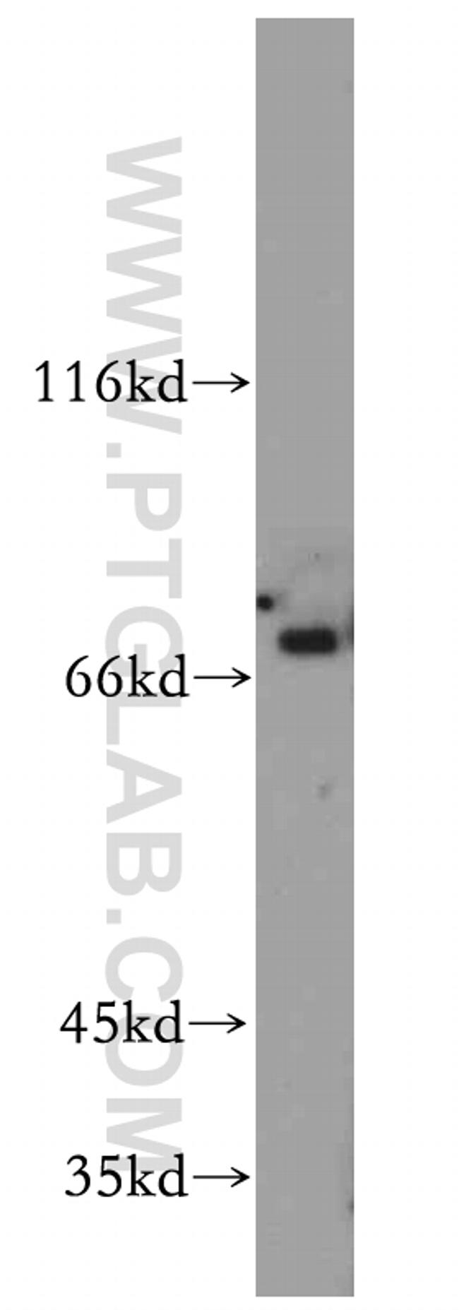 RANBP10 Antibody in Western Blot (WB)