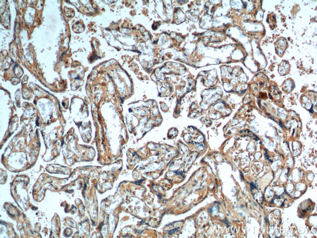 DKK1 Antibody in Immunohistochemistry (Paraffin) (IHC (P))