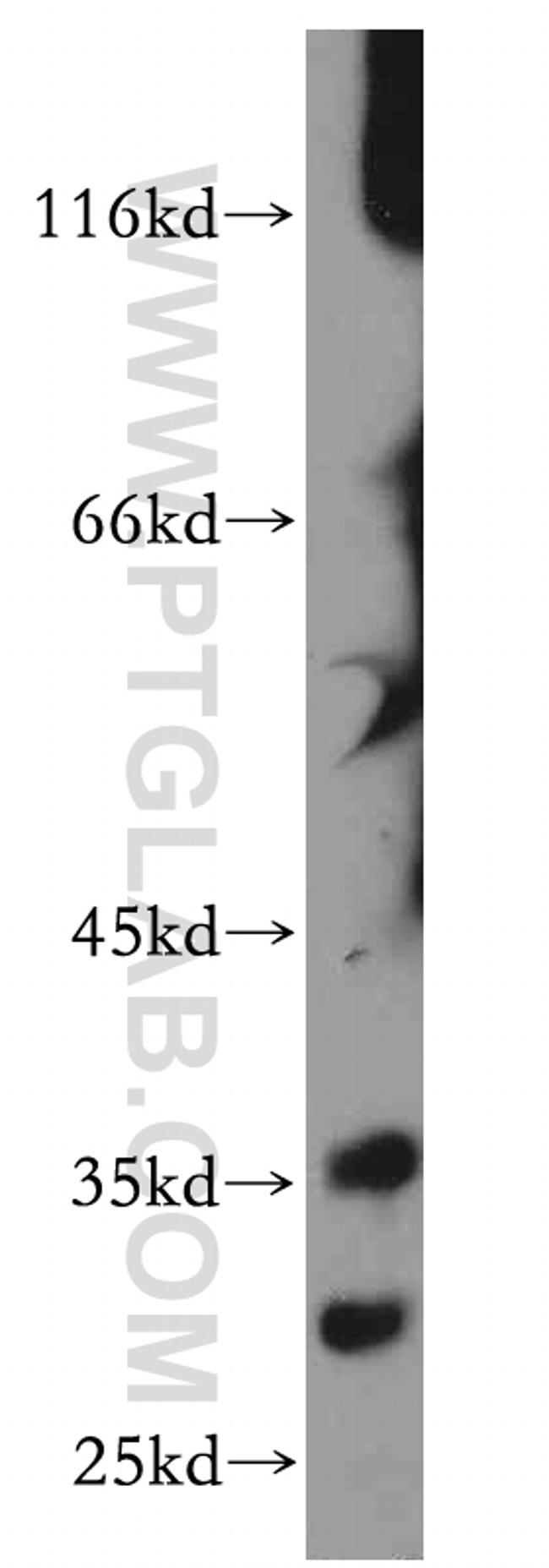 DKK1 Antibody in Western Blot (WB)