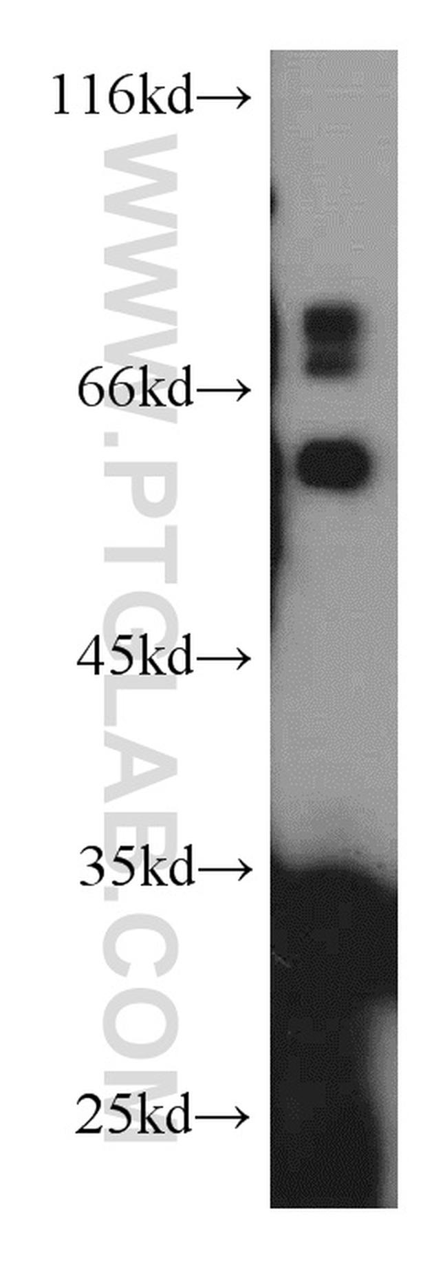 DKK1 Antibody in Western Blot (WB)