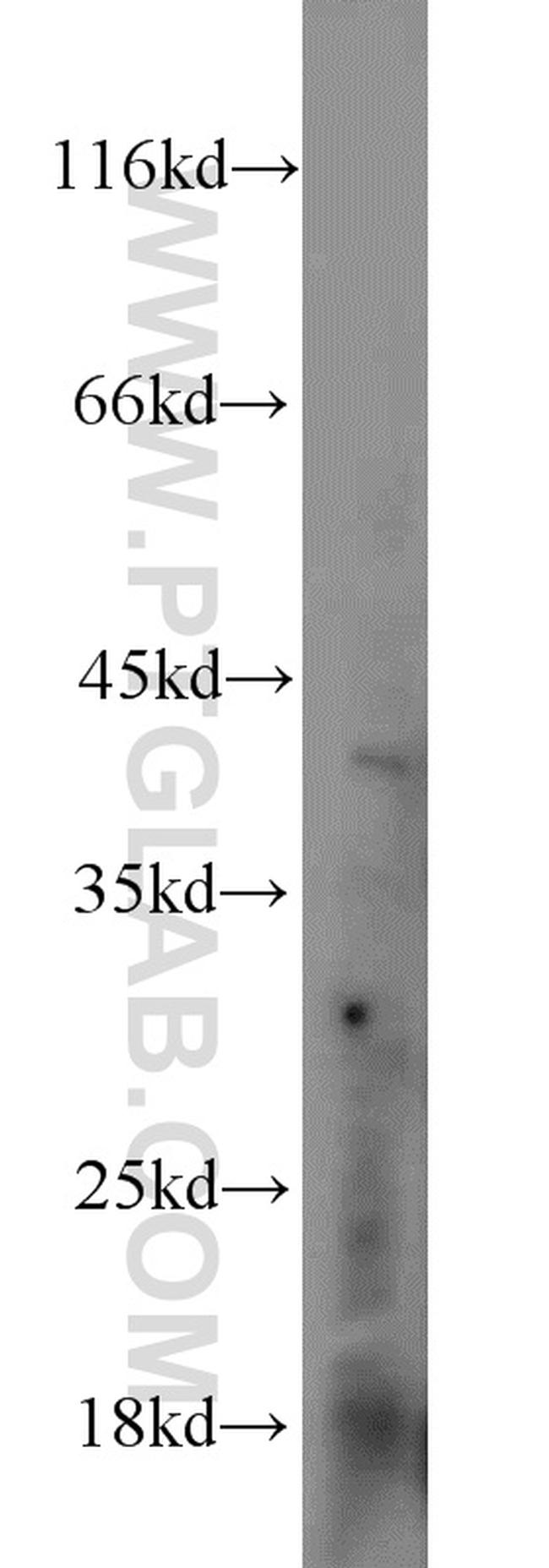 DKK1 Antibody in Western Blot (WB)