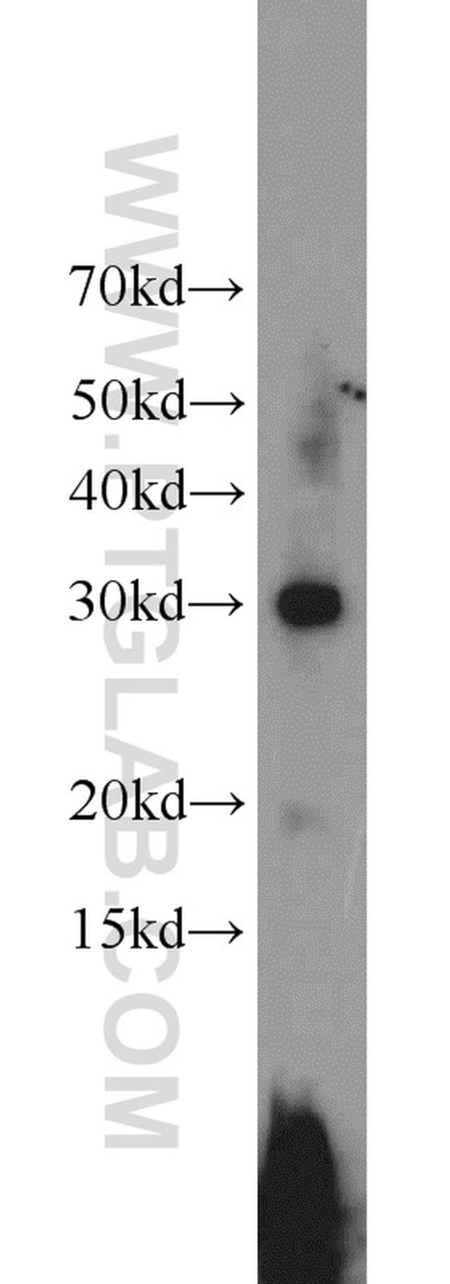 DKK1 Antibody in Western Blot (WB)