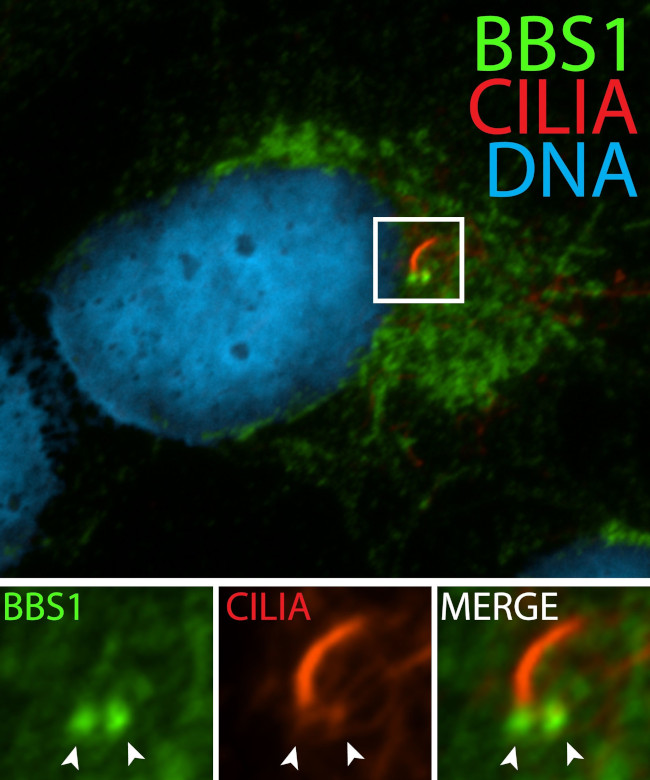 BBS1 Antibody in Immunocytochemistry (ICC/IF)