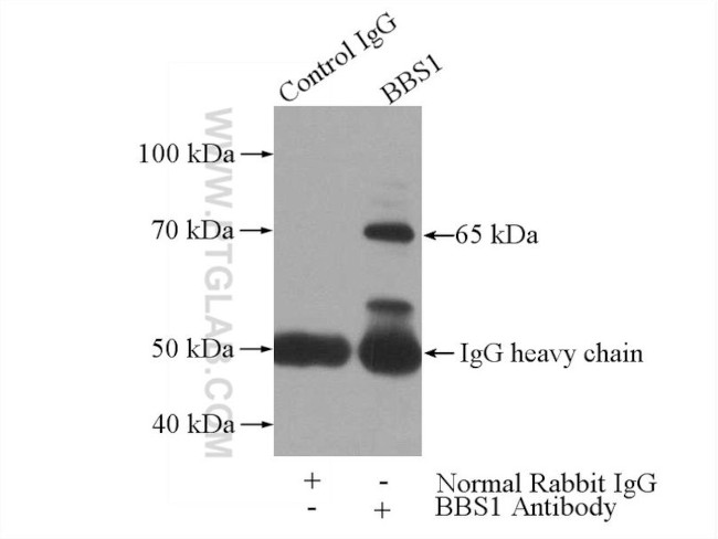 BBS1 Antibody in Immunoprecipitation (IP)