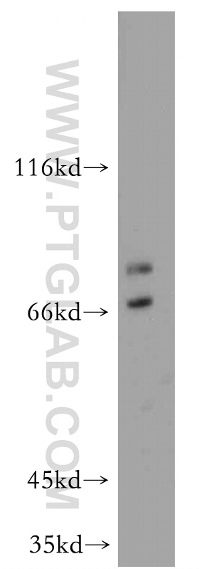 BBS1 Antibody in Western Blot (WB)