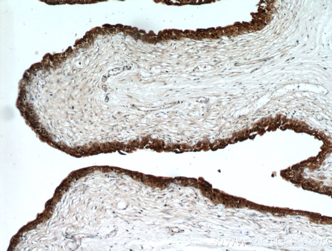 UPK2 Antibody in Immunohistochemistry (Paraffin) (IHC (P))