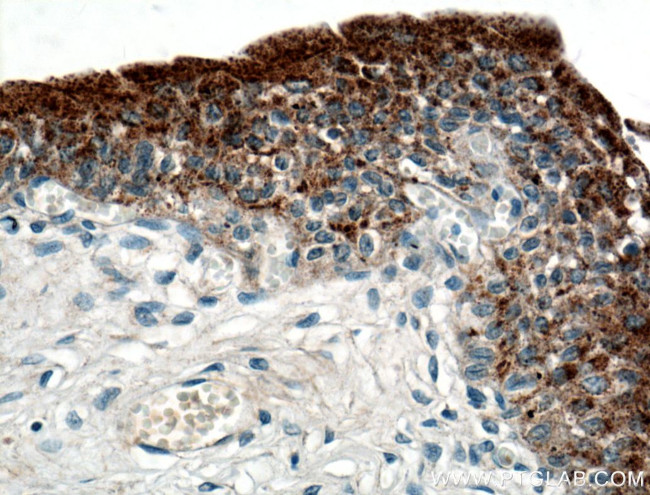 UPK2 Antibody in Immunohistochemistry (Paraffin) (IHC (P))