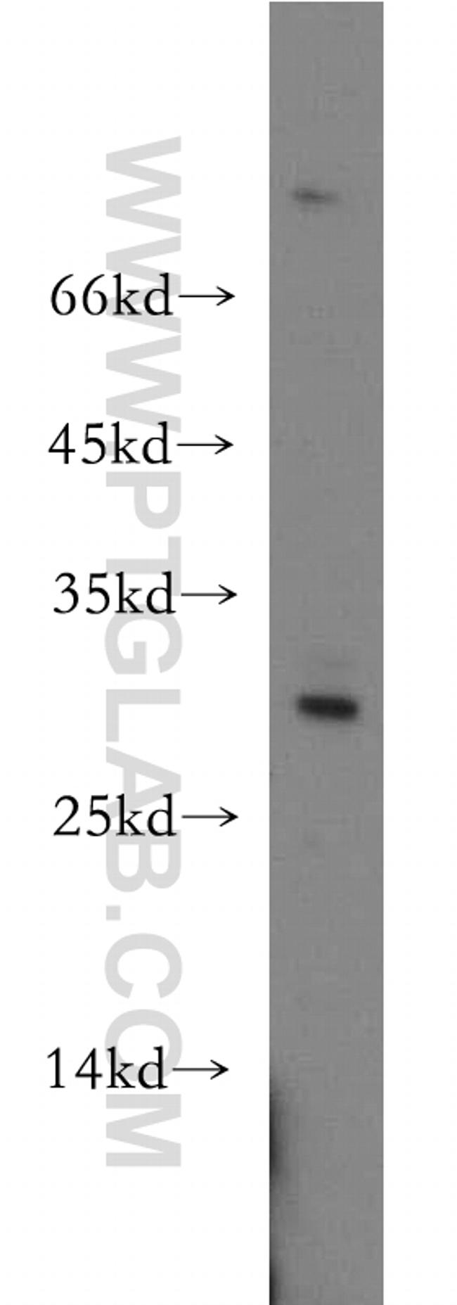 UPK2 Antibody in Western Blot (WB)