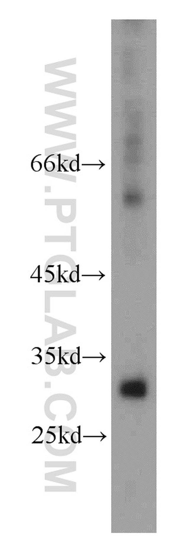 KIR2DS4 Antibody in Western Blot (WB)