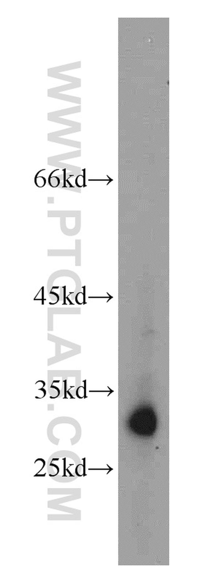 KIR2DS4 Antibody in Western Blot (WB)