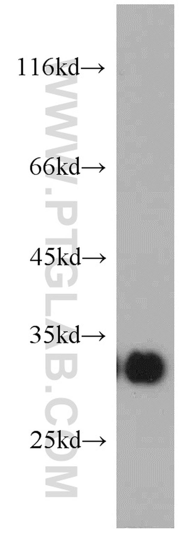 KIR2DS4 Antibody in Western Blot (WB)