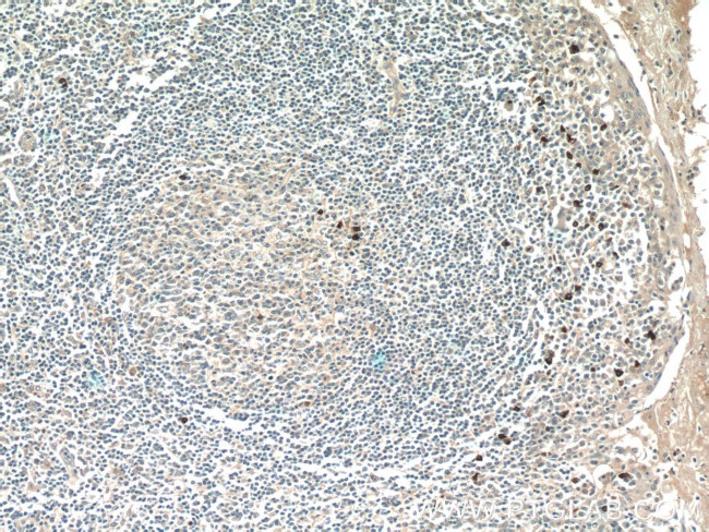 MKL1 Antibody in Immunohistochemistry (Paraffin) (IHC (P))