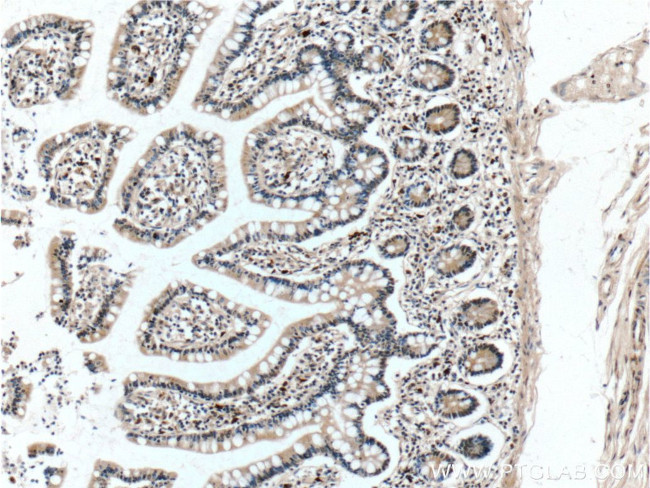 MKL1 Antibody in Immunohistochemistry (Paraffin) (IHC (P))