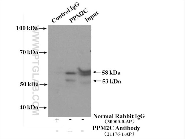 PPM2C Antibody in Immunoprecipitation (IP)