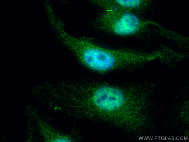 CBLL1 Antibody in Immunocytochemistry (ICC/IF)