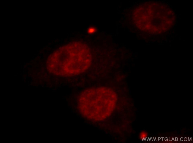 CBLL1 Antibody in Immunocytochemistry (ICC/IF)