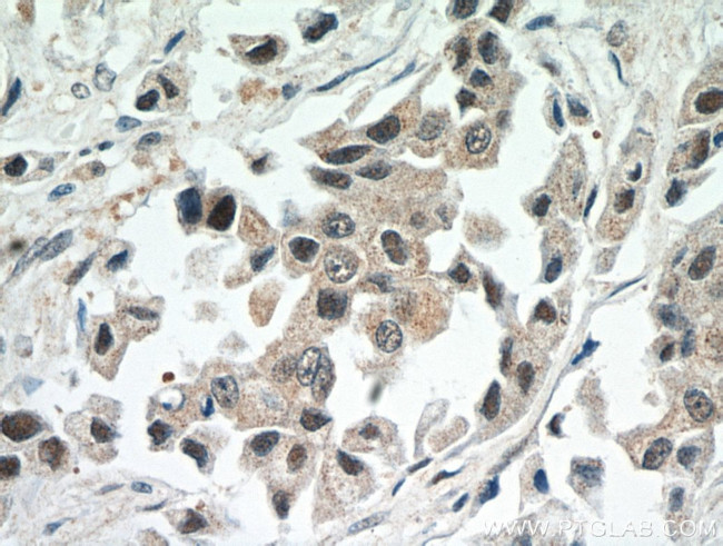 CBLL1 Antibody in Immunohistochemistry (Paraffin) (IHC (P))