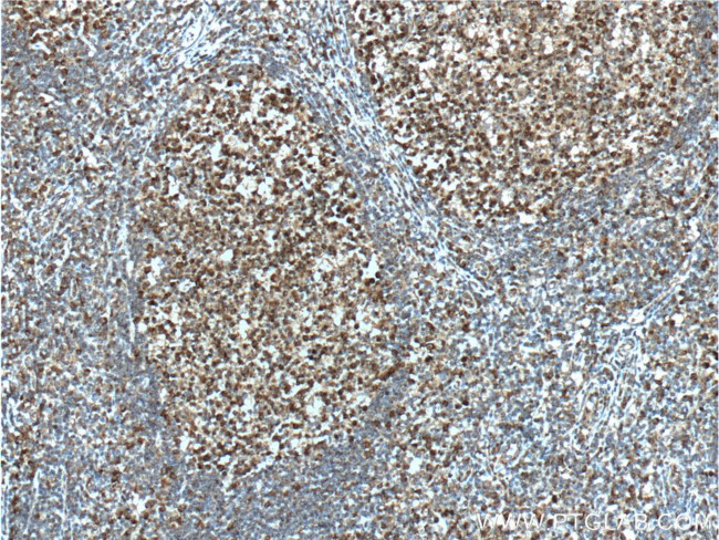 BCL6 Antibody in Immunohistochemistry (Paraffin) (IHC (P))