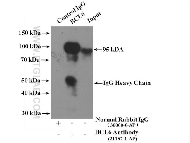 BCL6 Antibody in Immunoprecipitation (IP)