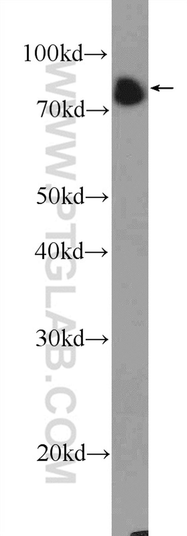 BCL6 Antibody in Western Blot (WB)