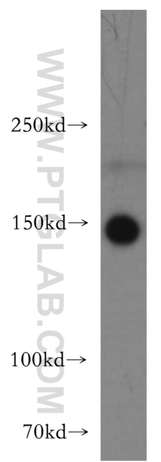 TAOK2 Antibody in Western Blot (WB)