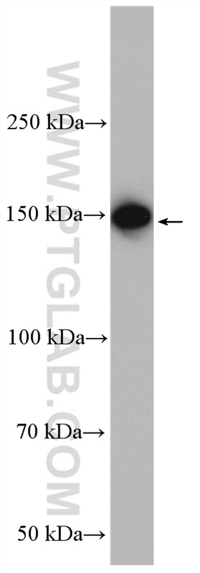 TAOK2 Antibody in Western Blot (WB)