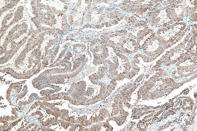 Mammaglobin B Antibody in Immunohistochemistry (Paraffin) (IHC (P))