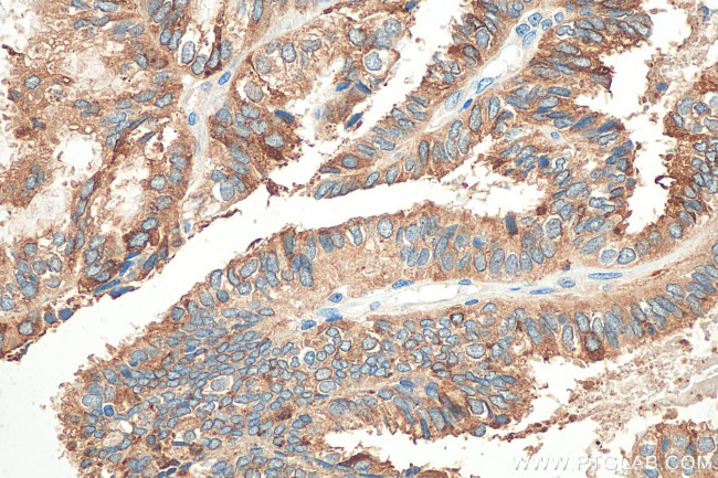 Mammaglobin B Antibody in Immunohistochemistry (Paraffin) (IHC (P))