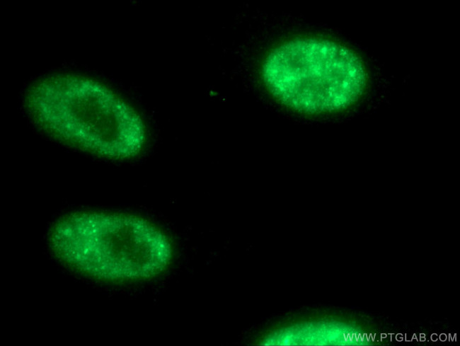 ATOH1 Antibody in Immunocytochemistry (ICC/IF)