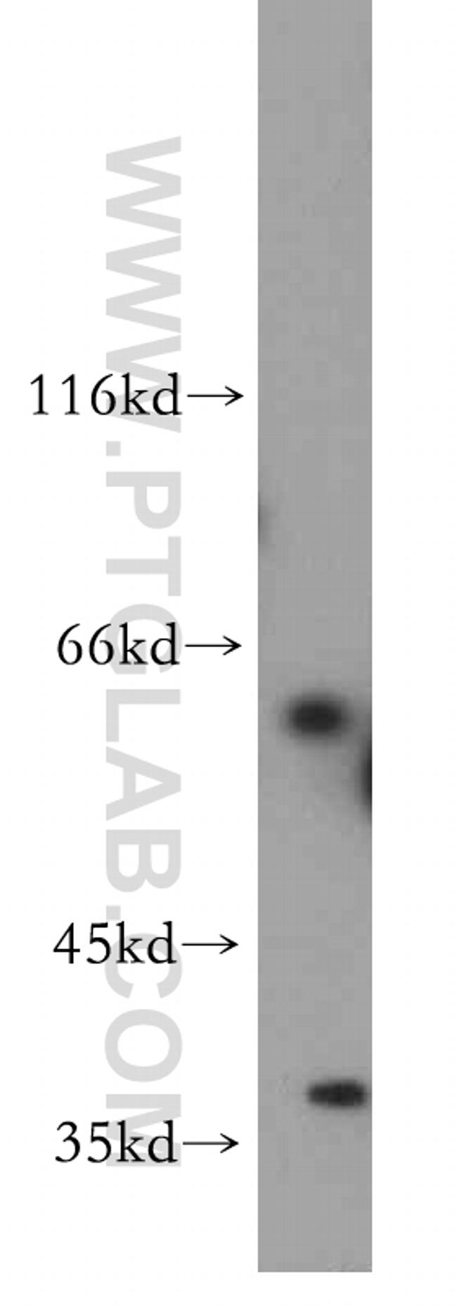 ADAD2 Antibody in Western Blot (WB)