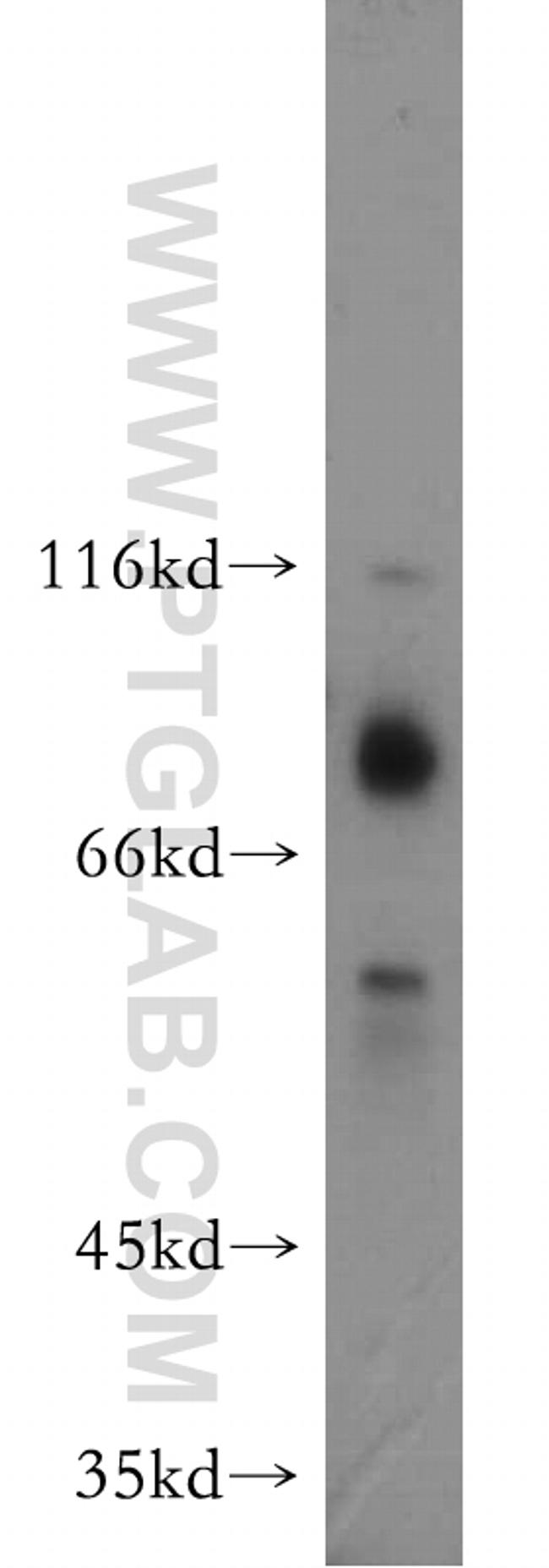 E2A Antibody in Western Blot (WB)
