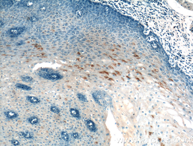 AGRP Antibody in Immunohistochemistry (Paraffin) (IHC (P))