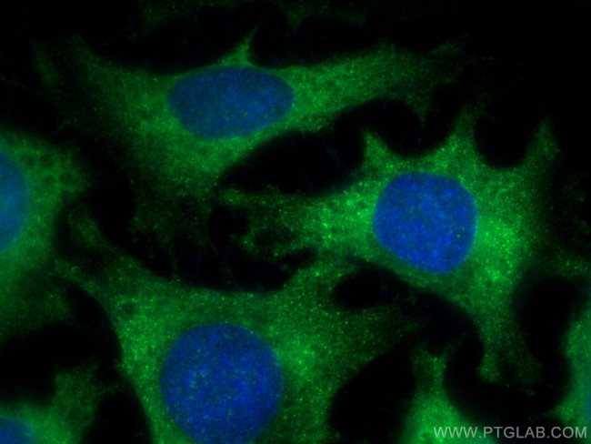 Catalase Antibody in Immunocytochemistry (ICC/IF)