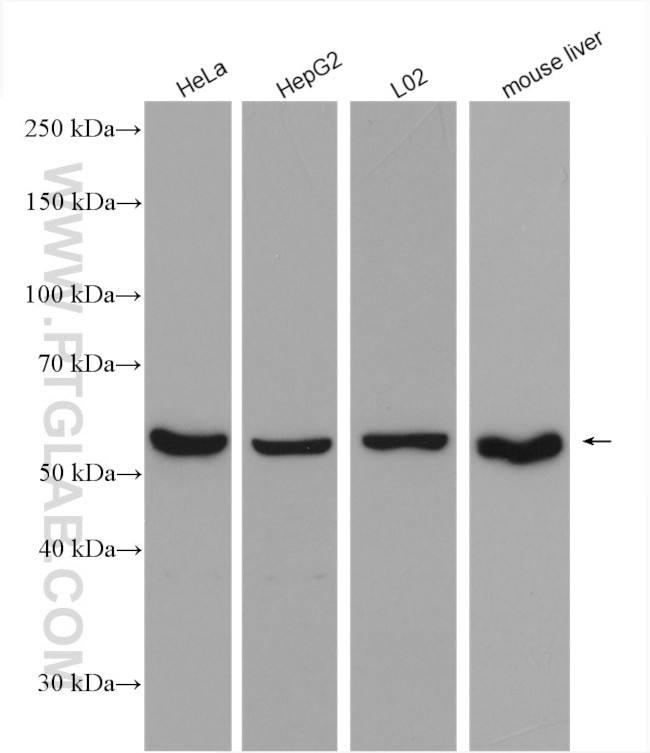 Catalase Antibody in Western Blot (WB)