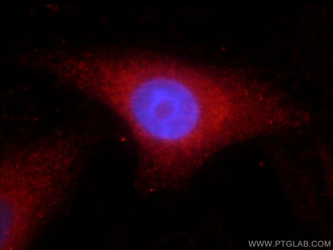 Catalase Antibody in Immunocytochemistry (ICC/IF)