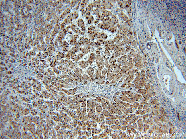 Catalase Antibody in Immunohistochemistry (Paraffin) (IHC (P))