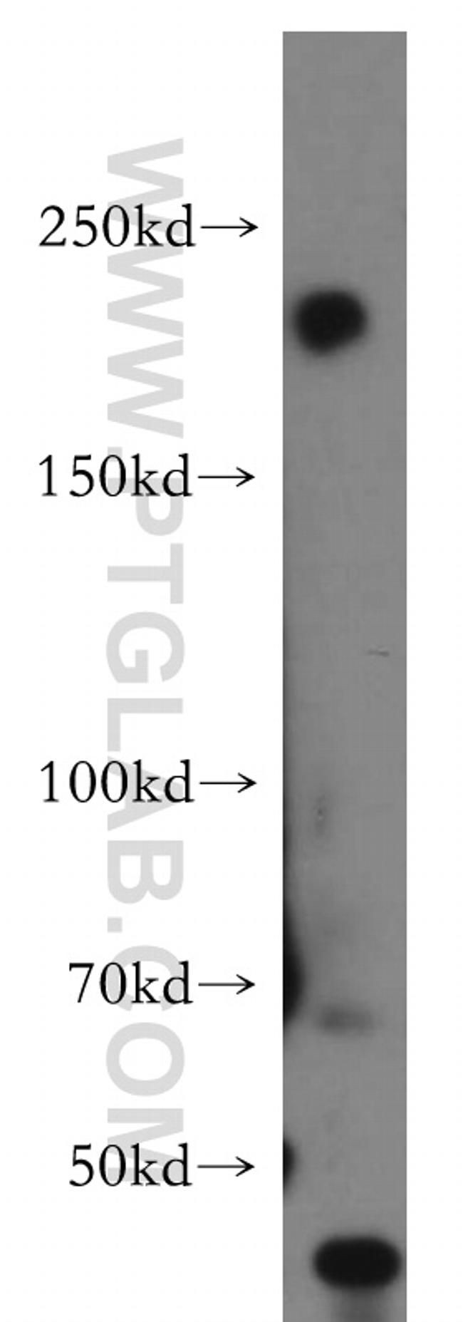 RB1CC1 Antibody in Western Blot (WB)