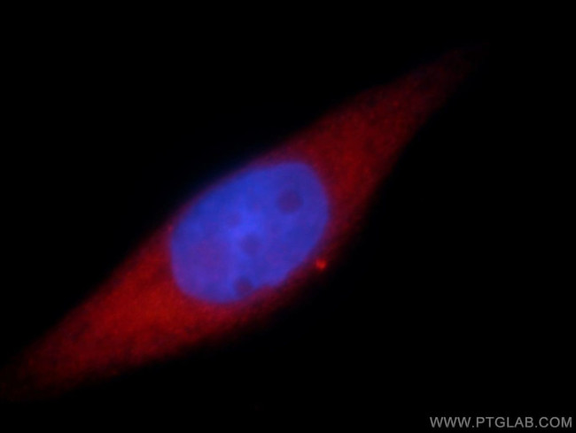 SMYD2 Antibody in Immunocytochemistry (ICC/IF)