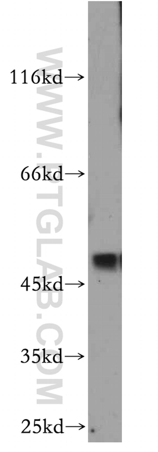 SMYD2 Antibody in Western Blot (WB)