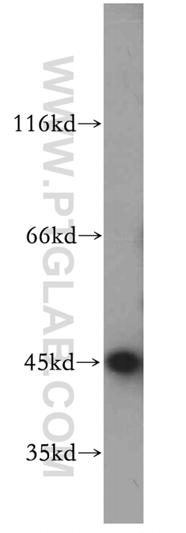 SMYD2 Antibody in Western Blot (WB)