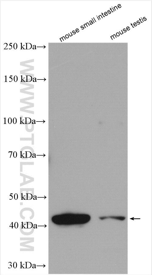 B3GNT6 Antibody in Western Blot (WB)