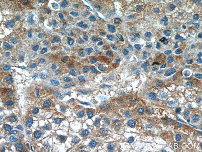 GTSE1 Antibody in Immunohistochemistry (Paraffin) (IHC (P))