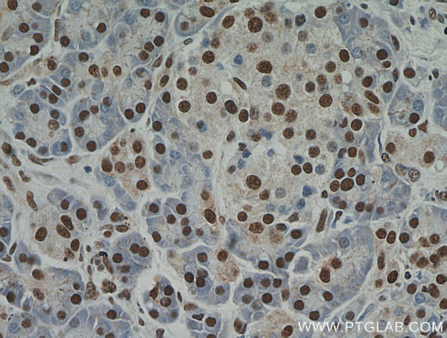 RBM39 Antibody in Immunohistochemistry (Paraffin) (IHC (P))