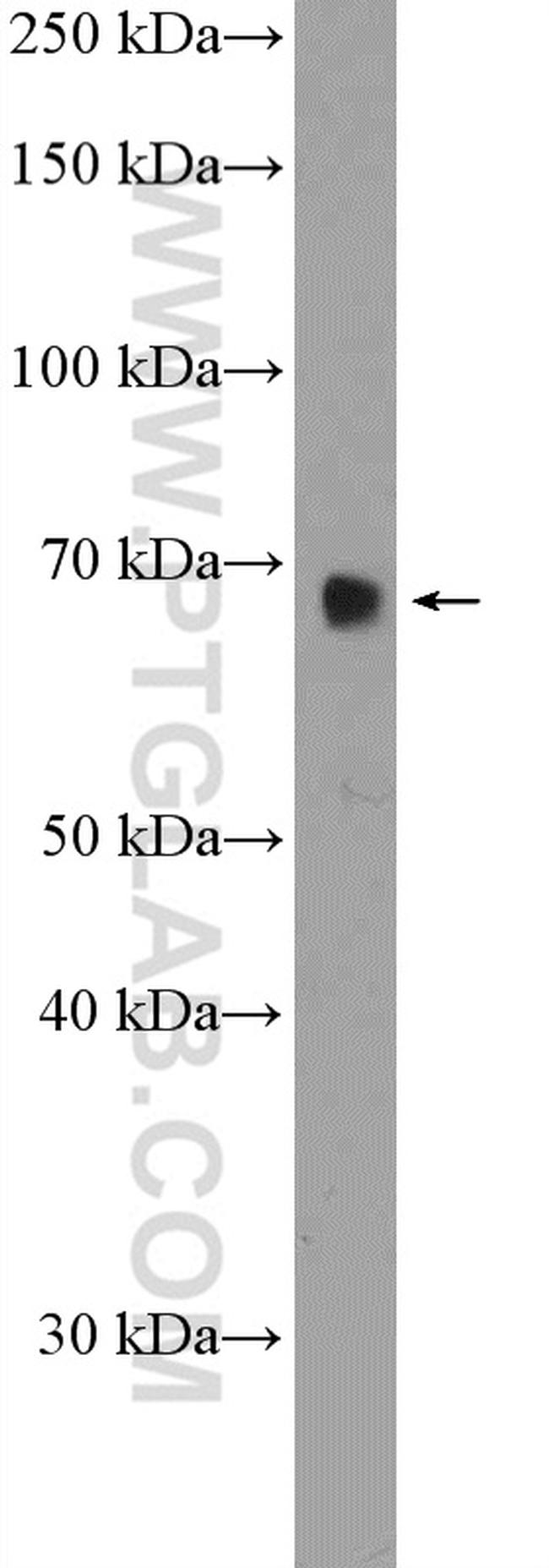 RBM39 Antibody in Western Blot (WB)