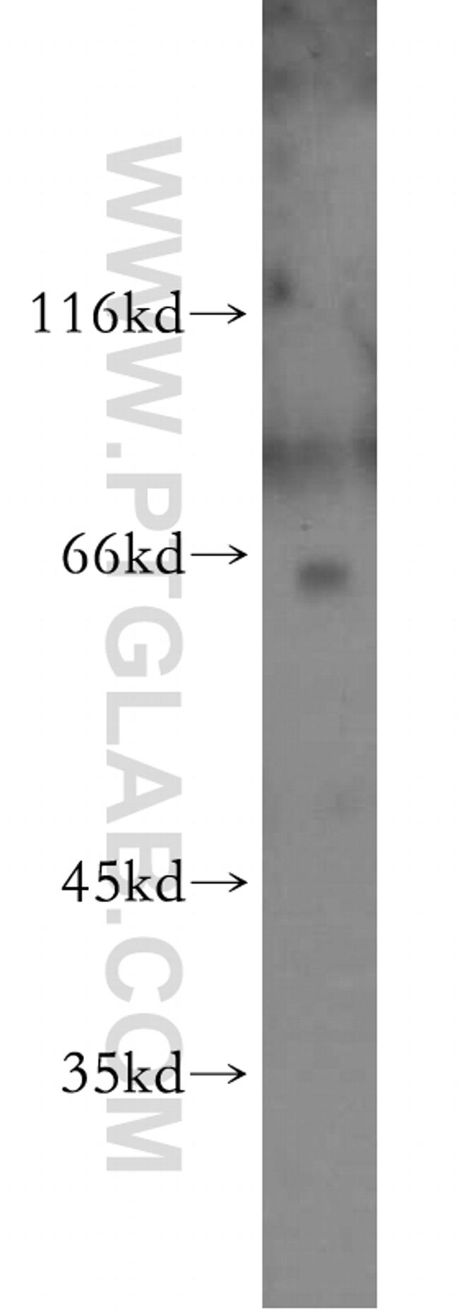 RBM39 Antibody in Western Blot (WB)